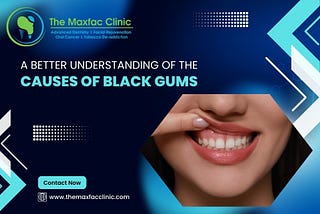 A better understanding of the causes of Black Gums