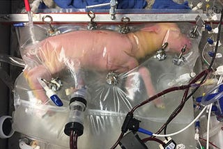 The Cutting Edge: Artificial Wombs