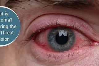 What is Glaucoma? Uncovering the Silent Threat to Vision