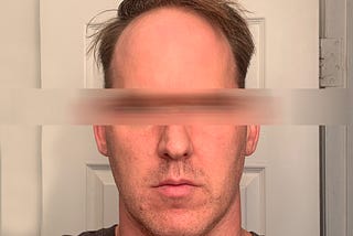 Everything I’ve Learned About Benign Paroxysmal Positional Vertigo (BPPV) in the Week I’ve Had It