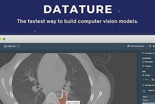 How to streamline your computer vision pipeline… without code?