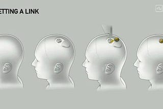 Neuralink — a Fitbit in your skull?