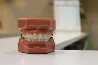 Denture model image: unsplash.com