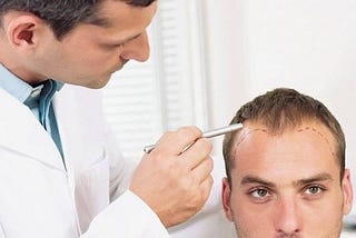 Know About Best Hair Loss Treatment Available