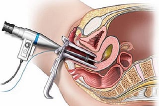 Hysteroscopy Centre in Delhi | Best Hysteroscopy Centre in Delhi | IVF Centre Delhi