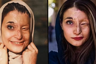 What They’re Doing To Iranian Women Should Horrify You