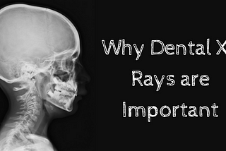 Why Dental X-Rays are Important