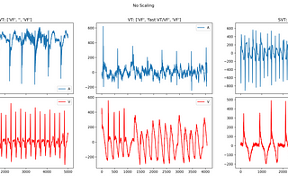 Feature Scaling in Real Cardiac Electrograms