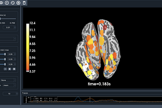 Understanding Brain-Computer Interfaces with Python