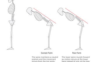 Disc Herniation Series (Part 2)