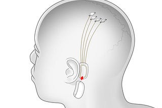 Neuralink — A link between man and machine: