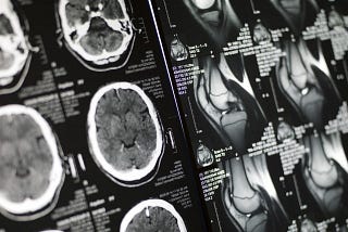 Generating MRI images of Multi-Contrast
