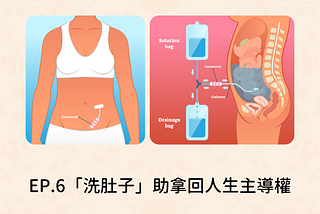EP.6「腹膜透析」拿回人生主導權