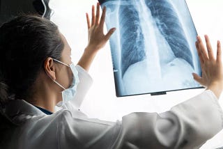 Expanding Lung Cancer Screening: New American Cancer Society Guidelines