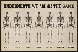 Only After We Die We Are All Seen As Equal.