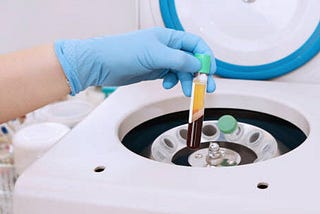 PRP (PLATELET RICH PLASMA) — ΤΟ ΠΙΟ ΙΣΧΥΡΟ SERUM