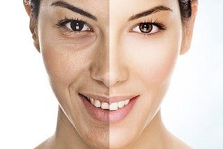 Get state-of-the-art Botox and Fillers Treatment Philadelphia!!!