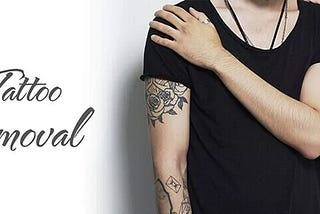 Tattoo Removal Center in Bangalore-Tattoo Removal Cream