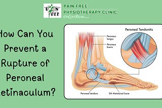 Rupture of Peroneal Retinaculum