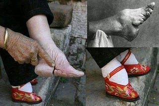 The most painful tradition done in the name of beauty- “Foot binding”