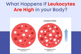 Understanding High Leukocytes: Implications for Health and Wellness