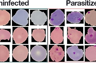 Malaria Disease Detection using Supervisely