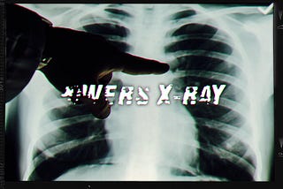 POWER’S X-RAY