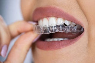 Transform Your Smile with Invisalign in New York City