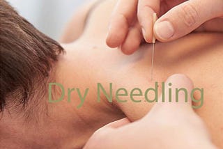 The Complete Guide to Dry Needling for Faster Injury Recovery