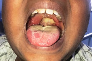 Diphtheria outbreak in Nigeria: situation report, problems and solutions.