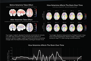 Measuring Ketamine’s Neuro Effects with Kernel Flow