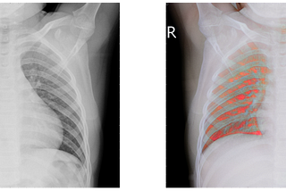 X-Ray Colorization and Neural Networks