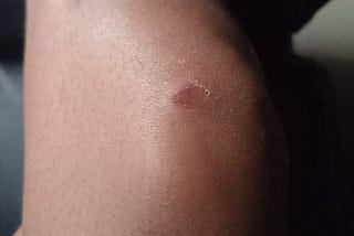 I Got Beaten Up by a Mad Man