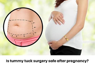 Is tummy tuck surgery safe after pregnancy?