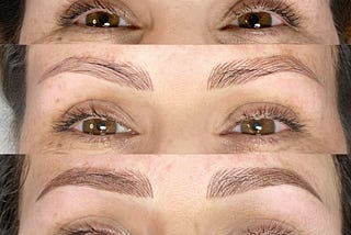 The “Combination Brow” Technique for an Identity Resurrection