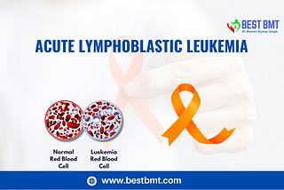 Understanding Acute Lymphoblastic Leukemia: Insights and Treatment Options
