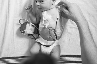 Newborn in diaper having heart holter monitor device removed by father