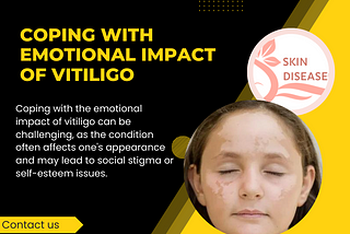 Coping with emotional impact of Vitiligo