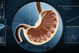 Japanese Endoscope AI Diagnosis in Vietnam