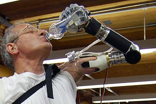 We have the technology to make bionic hands