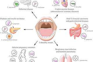 Bui, Fiona Q., et al. “Association between Periodontal Pathogens and Systemic Disease.” Biomedical Journal, vol. 42, no. 1, 2019, pp. 27–35., https://doi.org/10.1016/j.bj.2018.12.001