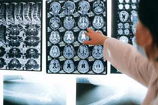 Brain Tumor: Symptoms and Signs