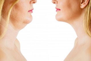 From Posture to Genetics: The Real Causes of a Double Chin Revealed