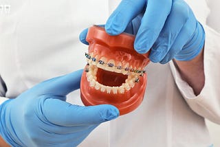 braces new york