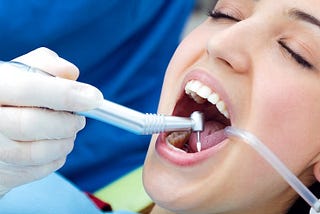 Unlocking the Benefits of Dental Implants: A Comprehensive Guide
