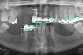 Deep learning object detection on dental x-rays – Clement Joudet – Medium