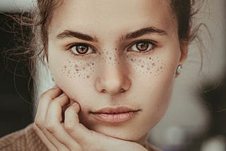 Portrait of a woman showing off her unique freckly features