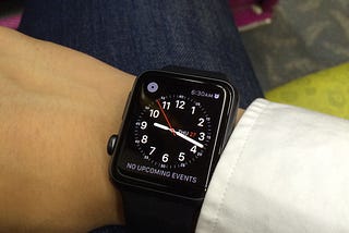 My two months experience with the Apple Watch (and the Apple advantage)