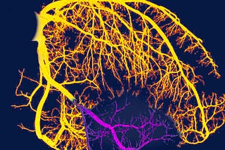 Exploring Heart Disease Risk Factors through Data Visualization