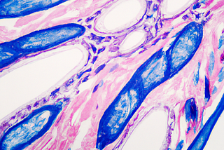 An AI generated image of imaginary connective tissue. The picture is abstract and has 3 colours: white, blue and pink. It almost looks like a cross section of a leaf, with different nodes and connective lines in between them.